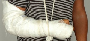 Broken Arm